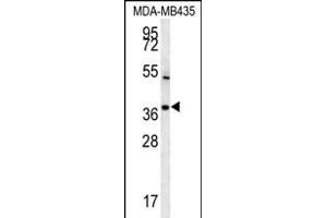 TNIP3 Antibody (N-term) (ABIN651787 and ABIN2840400) western blot analysis in MDA-M cell line lysates (15 μg/lane). (TNIP3 抗体  (N-Term))