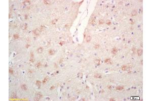 Formalin-fixed and paraffin embedded rat brain labeled with Rabbit Anti Phospho-PPIG (Ser376) Polyclonal Antibody, Unconjugated (ABIN746678) at 1:200 followed by conjugation to the secondary antibody and DAB staining