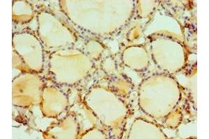 Immunohistochemistry of paraffin-embedded human thyroid tissue using ABIN7149566 at dilution of 1:100 (DIDO1 抗体  (AA 1-300))