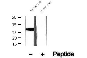 Western blot analysis of extracts of human testis tissue, using CRISP2 antibody. (CRISP2 抗体  (Internal Region))