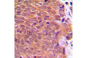 Immunohistochemistry (IHC) image for anti-Cofilin 1 (CFL1) (N-Term), (pSer3) antibody (ABIN7296066)