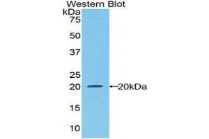 Western Blotting (WB) image for anti-Colony Stimulating Factor 1 Receptor (CSF1R) (AA 734-900) antibody (ABIN1174698) (CSF1R 抗体  (AA 734-900))