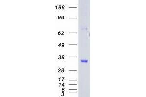 Western Blotting (WB) image for Cyclin-Dependent Kinase 5 (CDK5) protein (Myc-DYKDDDDK Tag) (ABIN2713865)
