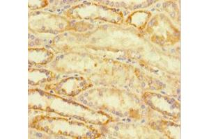 Immunohistochemistry of paraffin-embedded human kidney tissue using ABIN7172767 at dilution of 1:100 (ATRX 抗体  (AA 2161-2443))