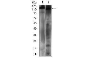 Western blot analysis using PTPRC mouse mAb against Hela (1) and A431 (2) cell lysate. (CD45 抗体  (AA 928-989))