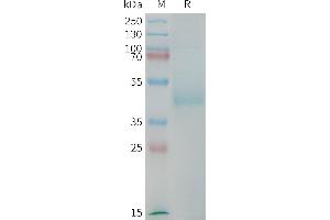 Human (567-667) Protein, mFc Tag on SDS-PAGE under reducing condition.