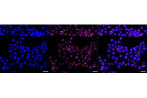 Immunocytochemical staining of HAP-1 cells with GST3 / GSTP1 antibody (ABIN7798758), 1:1,000). (Recombinant GSTP1 抗体)