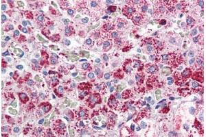 Adrenal, Human: Formalin-Fixed, Paraffin-Embedded (FFPE) (CCKAR 抗体  (Internal Region))