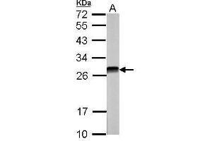 WB Image Sample (30 ug of whole cell lysate) A: NIH-3T3 12% SDS PAGE antibody diluted at 1:5000 (CSNK2B 抗体)