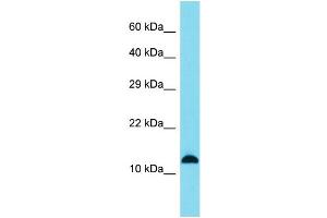 Host: Rabbit Target Name: SPANXB1 Sample Type: A549 Whole Cell lysates Antibody Dilution: 1. (SPANXB1 抗体  (Middle Region))