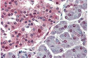 Human Pancreas: Formalin-Fixed, Paraffin-Embedded (FFPE) (c-MYC 抗体  (AA 408-439))