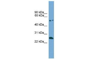 WB Suggested Anti-ETHE1 Antibody Titration: 0. (ETHE1 抗体  (Middle Region))