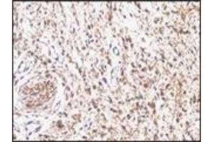 Immunohistochemistry (IHC) image for anti-S-100 (C-Term) antibody (ABIN870446) (S-100 抗体  (C-Term))