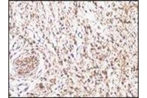 Immunohistochemistry (IHC) image for anti-S-100 (C-Term) antibody (ABIN870449) (S-100 抗体  (C-Term))