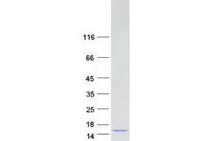 Western Blotting (WB) image for Catenin, beta Interacting Protein 1 (CTNNBIP1) (Transcript Variant 1) protein (Myc-DYKDDDDK Tag) (ABIN2712613)