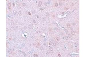 Immunohistochemistry of DLCK1 in rat brain tissue with DLCK1 antibody at 2. (DCLK1 抗体  (N-Term))