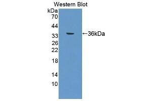 Detection of Recombinant TP, Human using Polyclonal Antibody to Thromboxane Receptor (TP) (TBXA2R 抗体  (AA 3-324))