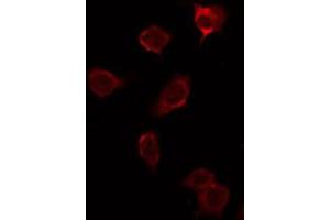 ABIN6276899 staining NIH-3T3 by IF/ICC. (Prosaposin 抗体  (Internal Region))