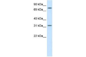 WB Suggested Anti-WNT8B Antibody Titration:  1. (WNT8B 抗体  (Middle Region))