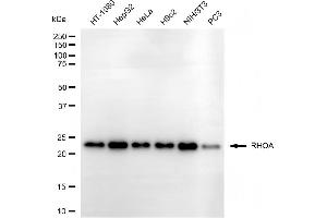 Western blotting analysis using RHOA antibody (ABIN7800142).