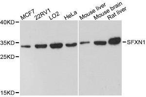 Western blot analysis of extracts of various cell lines, using SFXN1 antibody. (SFXN1 抗体  (AA 87-322))