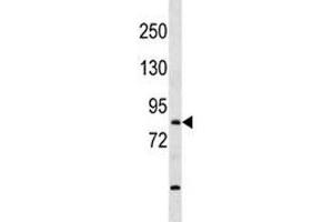 TBR1 antibody western blot analysis in mouse bladder tissue lysate (TBR1 抗体  (AA 52-80))