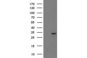 HEK293T cells were transfected with the pCMV6-ENTRY control (Left lane) or pCMV6-ENTRY HDHD2 (Right lane) cDNA for 48 hrs and lysed. (HDHD2 抗体)