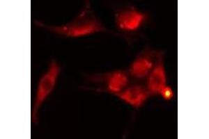 ABIN6276416 staining  Hela cells by IF/ICC. (TRAF2 抗体  (C-Term))