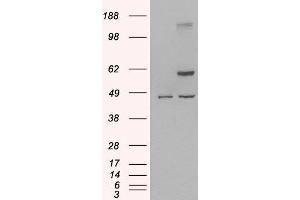 HEK293 overexpressing Human TRAF2 and probed with ABIN2560516 (mock transfection in first lane). (TRAF2 抗体  (C-Term))