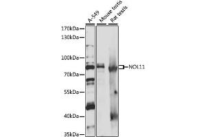 Western blot analysis of extracts of various cell lines, using NOL11 antibody (ABIN7269032) at 1:1000 dilution. (NOL11 抗体  (AA 300-600))
