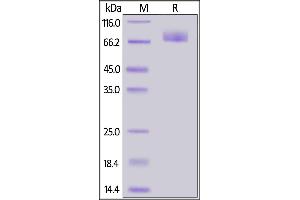 SDS-PAGE (SDS) image for SARS-CoV-2 Spike S2 (Active) protein (His tag) (ABIN7013246)