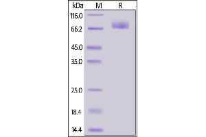 SARS-CoV-2 S2 protein, His Tag on  under reducing (R) condition. (SARS-CoV-2 Spike S2 Protein (His tag))