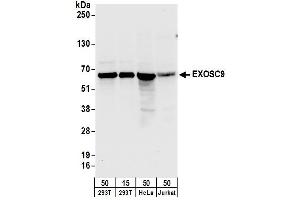 anti-Exosome Component 9 (EXOSC9) (AA 389-439) antibody