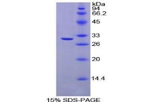 SDS-PAGE analysis of Chicken Carbonic Anhydrase II Protein. (CA2 蛋白)