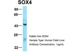 Western Blotting (WB) image for anti-SRY (Sex Determining Region Y)-Box 4 (SOX4) (N-Term) antibody (ABIN2780469)