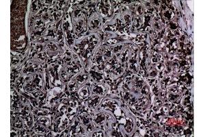 Immunohistochemistry (IHC) analysis of paraffin-embedded Human Breast, antibody was diluted at 1:100. (Histone 3 抗体  (meLys37))