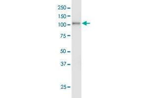 EPHA3 monoclonal antibody (M01), clone 3A12. (EPH Receptor A3 抗体  (AA 202-326))