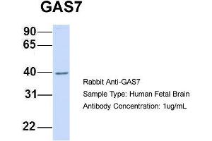 Host:  Rabbit  Target Name:  GAS7  Sample Type:  Human Fetal Brain  Antibody Dilution:  1. (GAS7 抗体  (N-Term))