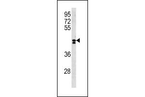 LRRC2 Antibody (N-term) (ABIN1881510 and ABIN2843288) western blot analysis in NCI- cell line lysates (35 μg/lane). (LRRC2 抗体  (N-Term))