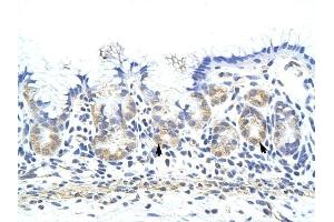 ZNF322A antibody was used for immunohistochemistry at a concentration of 4-8 ug/ml to stain Epithelial cells of fundic gland (arrows) in Human Stomach. (ZNF322A 抗体  (C-Term))