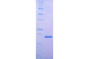 SDS-PAGE (SDS) image for Fibroblast Growth Factor 7 (FGF7) (Active) protein (ABIN2452198) (FGF7 蛋白)
