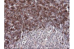 Immunohistochemistry (IHC) image for anti-T-cell surface glycoprotein CD1c (CD1C) antibody (ABIN2670658) (CD1c 抗体)