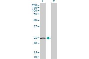 Western Blot analysis of NDUFS8 expression in transfected 293T cell line by NDUFS8 MaxPab polyclonal antibody. (NDUFS8 抗体  (AA 1-210))