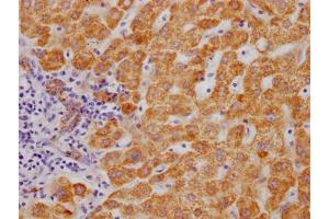 IHC image of ABIN7127628 diluted at 1:100 and staining in paraffin-embedded human liver tissue performed on a Leica BondTM system. (Recombinant Monoamine Oxidase B 抗体)
