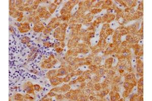 IHC image of ABIN7127628 diluted at 1:100 and staining in paraffin-embedded human liver tissue performed on a Leica BondTM system.