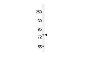 Western blot analysis in NCI-H460 cell line lysates (35ug/lane). (SLCO4C1 抗体  (C-Term))