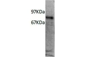 Western Blotting (WB) image for anti-Interleukin 7 Receptor (IL7R) antibody (ABIN6923149) (IL7R 抗体)