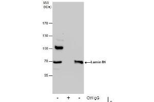 IP Image Immunoprecipitation of Lamin B1 protein from 293T whole cell extracts using 5 μg of Lamin B1 antibody, Western blot analysis was performed using Lamin B1 antibody, EasyBlot anti-Rabbit IgG  was used as a secondary reagent. (Lamin B1 抗体)