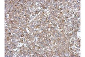 IHC-P Image Immunohistochemical analysis of paraffin-embedded Hela xenograft, using C18orf25, antibody at 1:500 dilution. (C18ORF25 抗体)