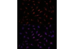 Immunofluorescence analysis of U-2 OS cells using DNTTIP2 antibody (ABIN7266732) at dilution of 1:100. (DNTTIP2 抗体  (AA 1-300))